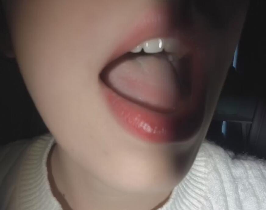 菜菜cyl不好吃 口腔检查.